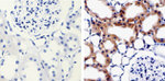 MMP16 Antibody in Immunohistochemistry (Paraffin) (IHC (P))