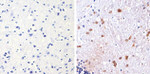 S100B Recombinant Rabbit Monoclonal Antibody (16H24L21)