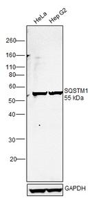 SQSTM1 Antibody in Western Blot (WB)