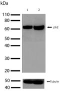SQSTM1 Antibody in Western Blot (WB)