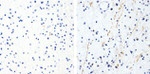 Phospho-Tau (Thr181) Antibody in Immunohistochemistry (Paraffin) (IHC (P))