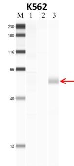 Phospho-SMAD2 (Ser465, Ser467) Antibody in RNA Immunoprecipitation (RIP)