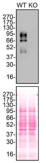 TGFBR2 Antibody in Western Blot (WB)