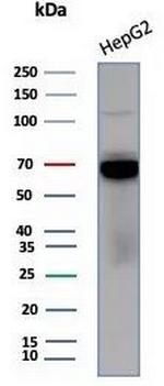 Transferrin (Early Marker of Oligodendrocytes) Antibody in Western Blot (WB)