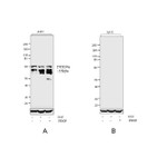 Phospho-FOXO4 (Thr28) Antibody in Western Blot (WB)