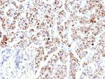 TFAM/TCF6 (Transcription factor A mitochondrial)/mtTFA Monoclonal Antibody (TFAM/9713)