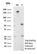 TFAM/TCF6 (Transcription factor A mitochondrial)/mtTFA Antibody in SDS-PAGE (SDS-PAGE)