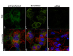 Glutaminase Recombinant Rabbit Monoclonal Antibody (6H5L15)