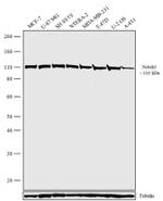 NOTCH3 Recombinant Rabbit Monoclonal Antibody (4H5L17)