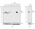 TPH2 Antibody in Western Blot (WB)