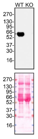 alpha-1 Antitrypsin Antibody