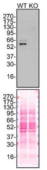 alpha-1 Antitrypsin Antibody