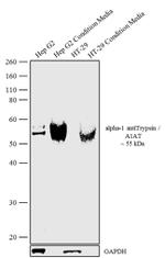 alpha-1 Antitrypsin Recombinant Rabbit Monoclonal Antibody (8H10L18)