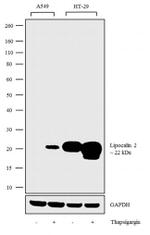 NGAL Recombinant Rabbit Monoclonal Antibody (11H10L7)