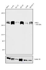 ASK1 Recombinant Rabbit Monoclonal Antibody (12H12L11)