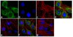 Phospho-MYL9 (Thr18, Ser19) Recombinant Rabbit Monoclonal Antibody (18H3L4)