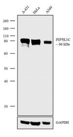 PIP5K1C Antibody in Western Blot (WB)