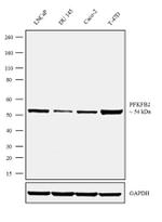 PFKFB2 Recombinant Rabbit Monoclonal Antibody (2H2L15)