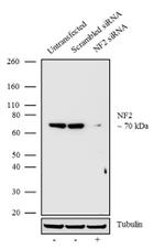 NF2 Antibody in Western Blot (WB)