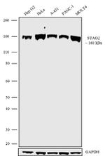 STAG2 Antibody in Western Blot (WB)