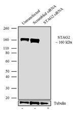 STAG2 Antibody in Western Blot (WB)
