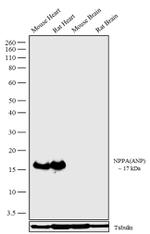 ANP Recombinant Rabbit Monoclonal Antibody (17H19L1)