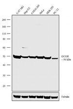 Glucagon Receptor Antibody in Western Blot (WB)