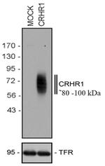 CRHR1 Antibody in Western Blot (WB)