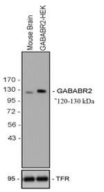 GABBR2 Antibody in Western Blot (WB)