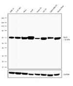 ELP3 Recombinant Rabbit Monoclonal Antibody (8H8L24)