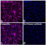 LDHA Antibody in Immunocytochemistry (ICC/IF)