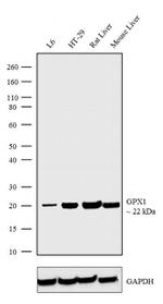GPX1 Recombinant Rabbit Monoclonal Antibody (5H1L9)