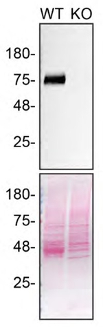 LIMP2 Antibody in Western Blot (WB)