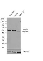 Parkin Chimeric Recombinant Mouse Monoclonal Antibody (21H24L9)