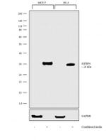 IGFBP4 Recombinant Rabbit Monoclonal Antibody (20H35L1)