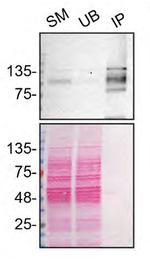 ADNP Antibody in Immunoprecipitation (IP)
