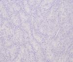 Transcription factor E3/TFE3 (Transcription Factor) Recombinant Rabbit Monoclonal Antibody (TFE3/6849R)