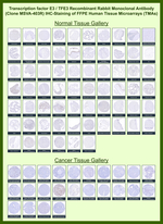Transcription factor E3/TFE3 (Transcription Factor) Recombinant Rabbit Monoclonal Antibody (MSVA-403R)