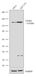 TAOK1 Recombinant Rabbit Monoclonal Antibody (1H3L17)