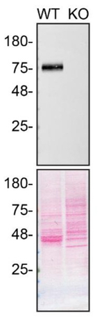 LIMP2 Antibody in Western Blot (WB)