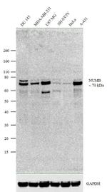 NUMB Recombinant Rabbit Monoclonal Antibody (14H45L9)