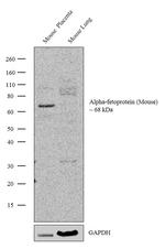 AFP Recombinant Rabbit Monoclonal Antibody (3H2L7)