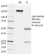 pS2/pNR-2/TFF1 (Estrogen-Regulated Protein) Antibody in SDS-PAGE (SDS-PAGE)