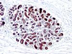 pS2/pNR-2/TFF1 (Estrogen-Regulated Protein) Antibody in Immunohistochemistry (Paraffin) (IHC (P))