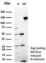 pS2/pNR-2/TFF1 (Estrogen-Regulated Protein) Antibody in SDS-PAGE (SDS-PAGE)
