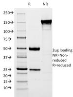 pS2/pNR-2/TFF1 (Estrogen-Regulated Protein) Antibody in SDS-PAGE (SDS-PAGE)