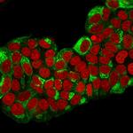 pS2/pNR-2/TFF1 (Estrogen-Regulated Protein) Antibody in Immunocytochemistry (ICC/IF)