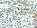 pS2/pNR-2/TFF1 (Estrogen-Regulated Protein) Antibody in Immunohistochemistry (Paraffin) (IHC (P))