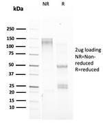 pS2/pNR-2/TFF1 (Estrogen-Regulated Protein) Antibody in SDS-PAGE (SDS-PAGE)