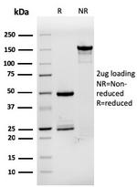 pS2/pNR-2/TFF1 (Estrogen-Regulated Protein) Antibody in SDS-PAGE (SDS-PAGE)